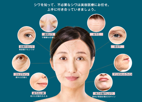 湘南美容クリニックのあごヒアルロン酸