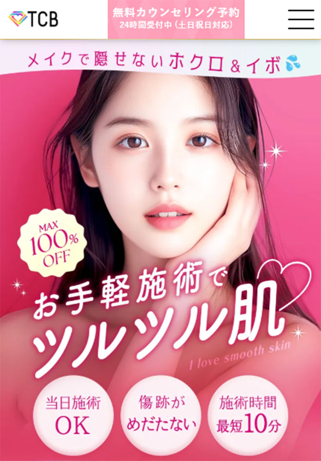 TCBホクロ